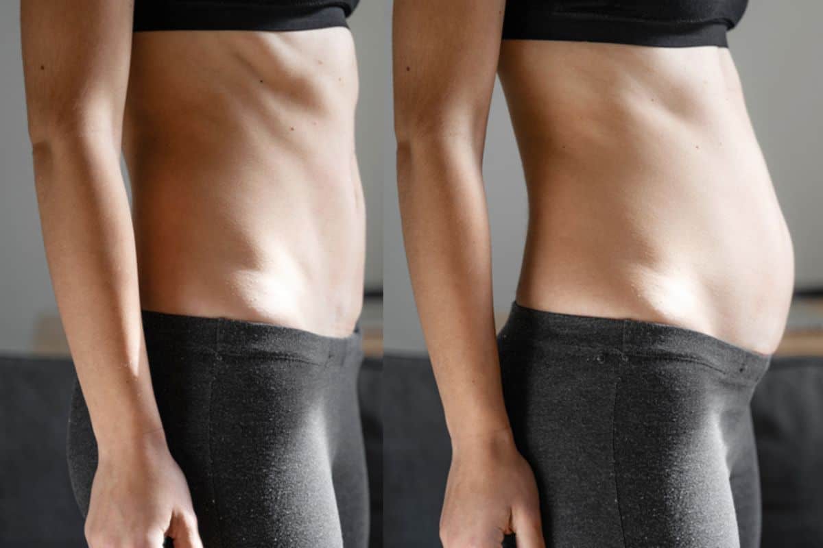 How long does diastasis recti take to improve Hammersmith?