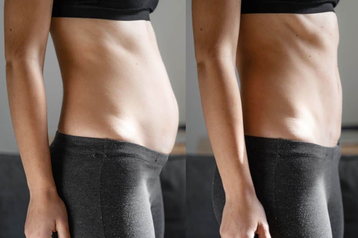 Post-Pregnancy: What Happens to Your Abdominal Muscles After Birth Hammersmith