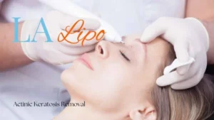 Woman receiving Actinic Keratosis Removal Treatment Hammersmith