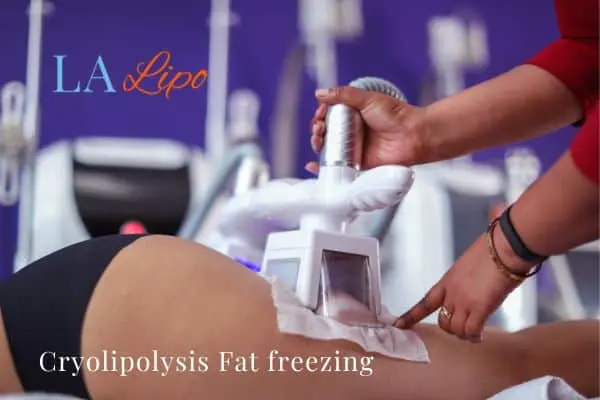 women getting fat freezing Hammersmith