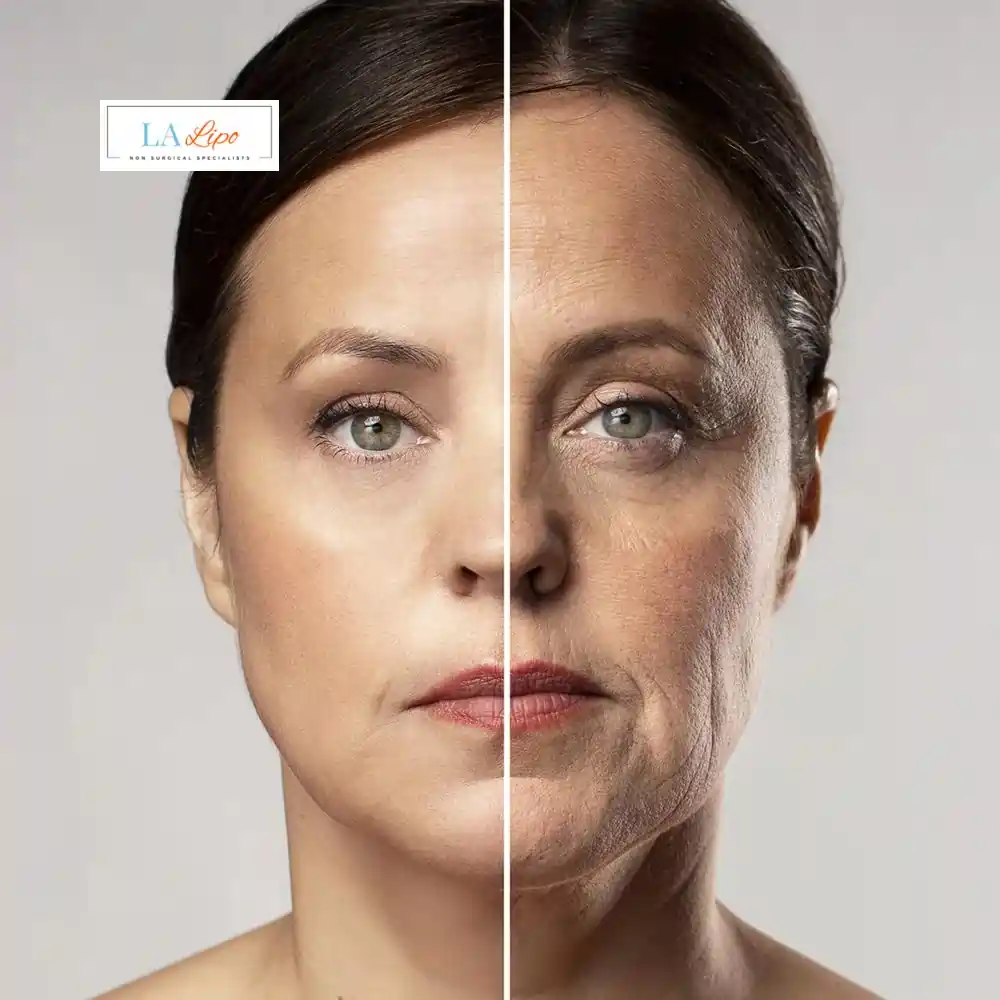 How Can You Tell If Non-Surgical Skin Tightening Is Right for You Hammersmith?