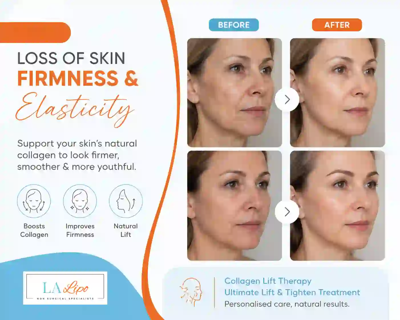 Sign #7: Loss of Skin Firmness and Elasticity Hammersmith